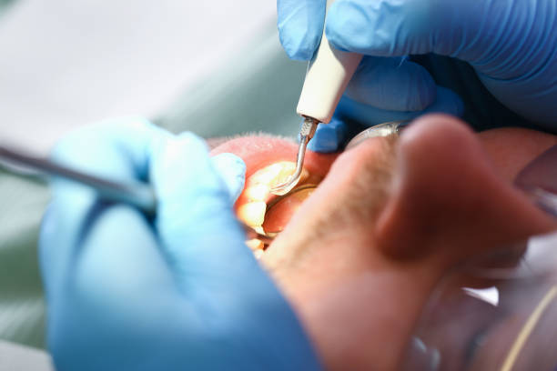 Best Pediatric Emergency Dentist in Luling, TX