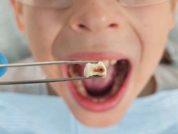 Best Weekend Emergency Dentist in Luling, TX